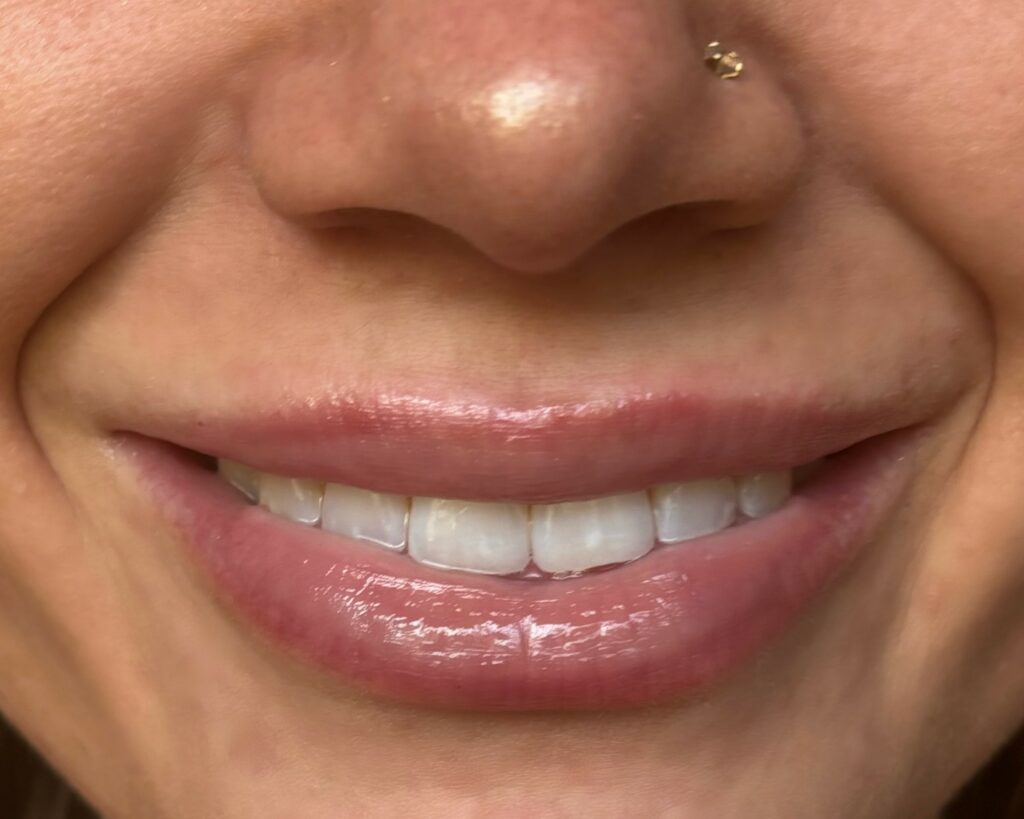 Close-up of smiling person with glossy lips and gold nose ring