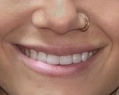 Close-up of smiling person with white teeth and gold nose ring.