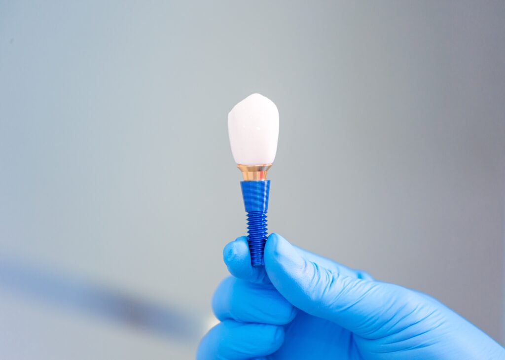 All-on-4 Implants Henderson