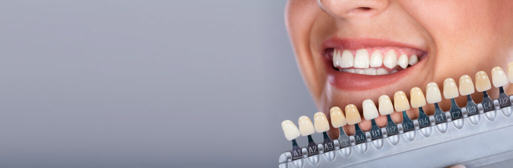 Tooth-Colored Fillings Henderson